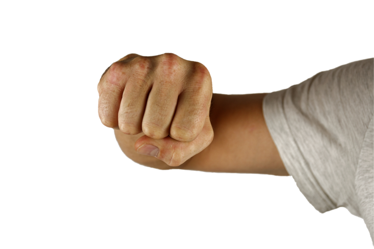 Am Sonntagmorgen kam es zu einer Schlägerei in der Alleestraße in PS. 